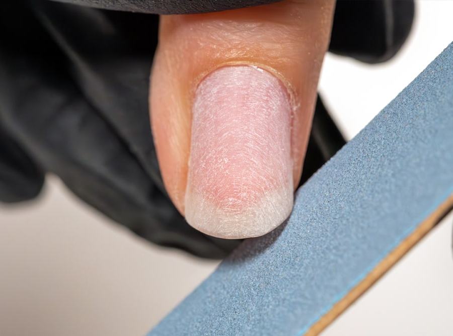 Limage de l'ongle naturel