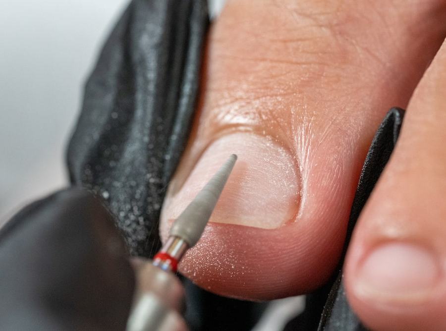 Préparation de l'ongle