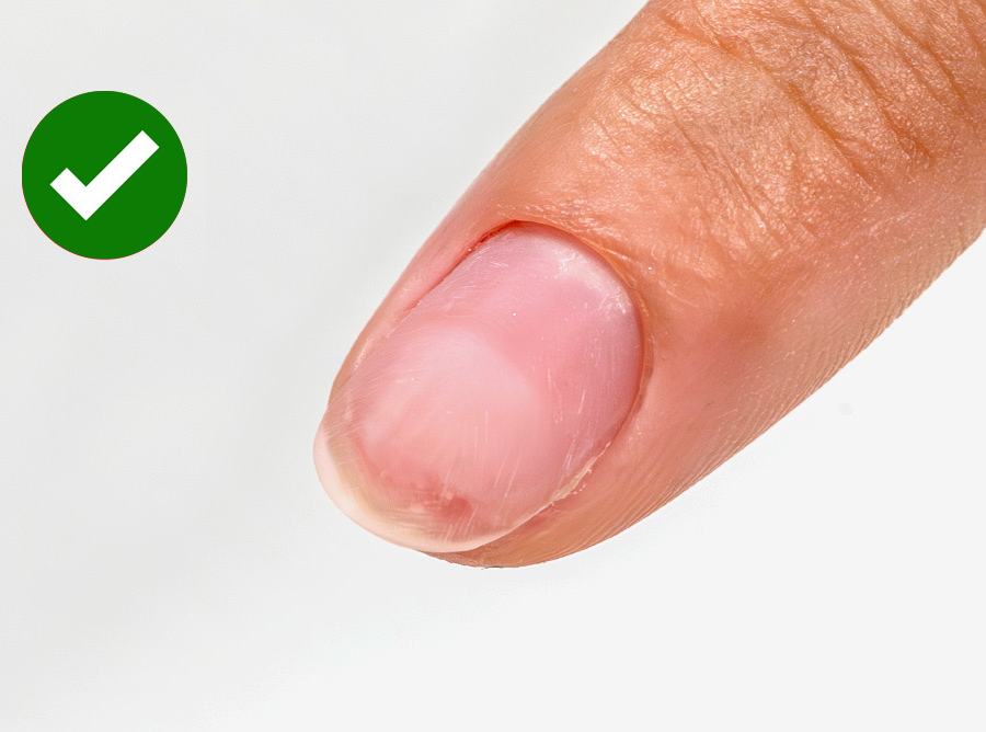 La solution efficace à 100%